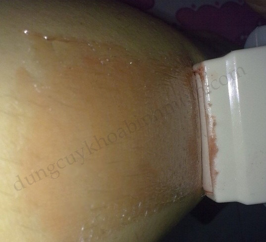 tẩy wax lông bằng máy